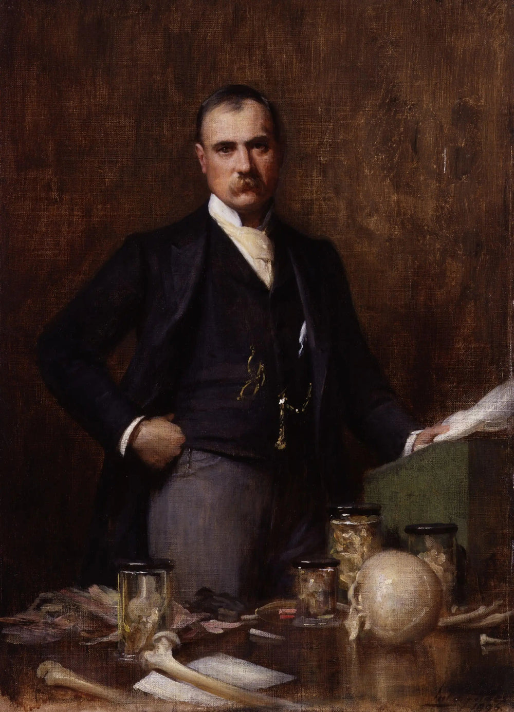 Sir Frederick Treves 1er baronnet - Luke Fildes - Alpha Reproduction