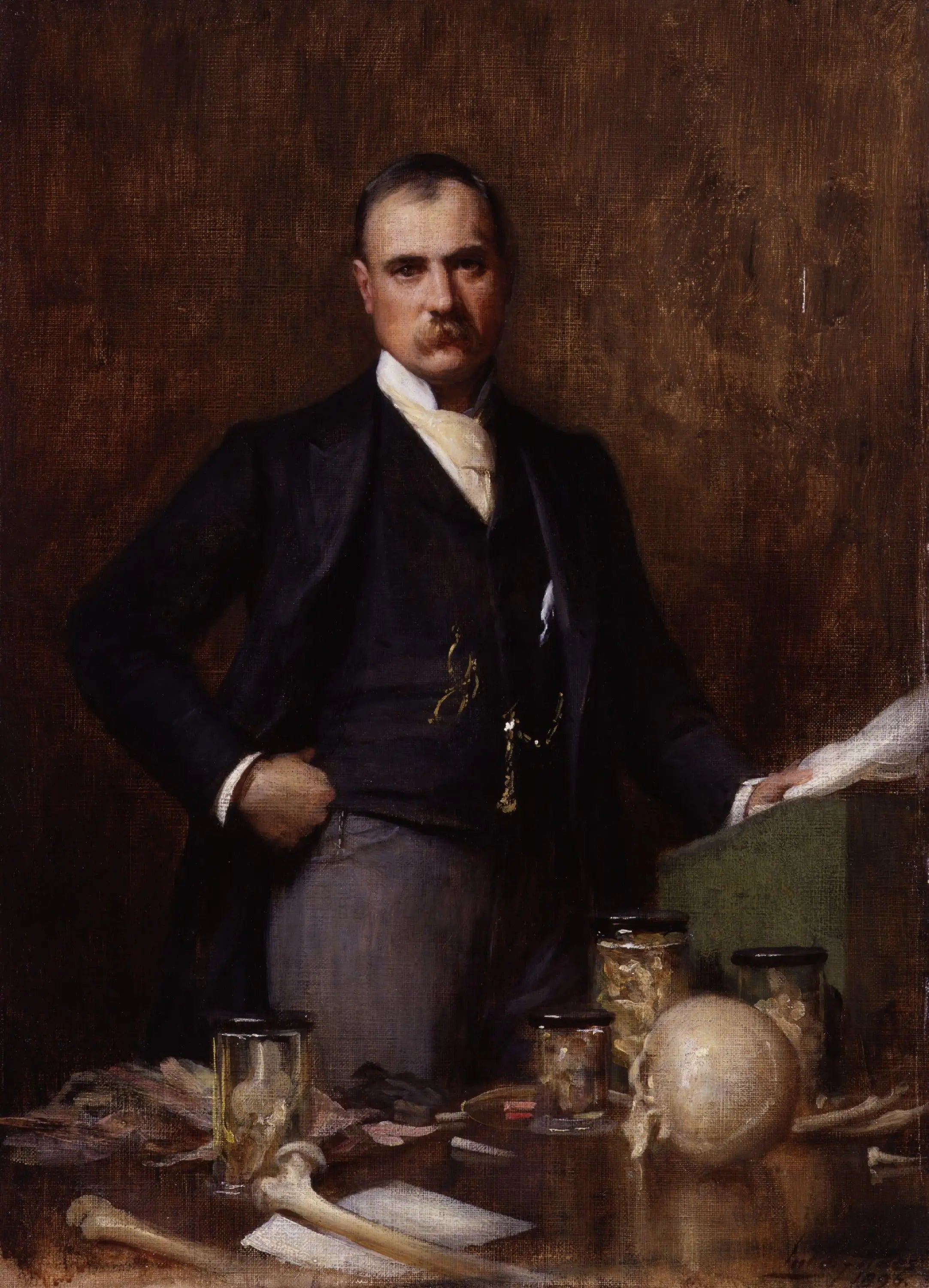 Sir Frederick Treves 1er baronnet - Luke Fildes - Alpha Reproduction