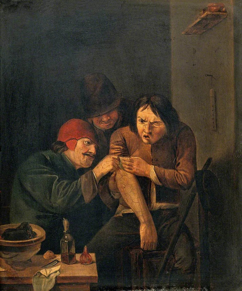 Un chirurgien soigne le bras d'un homme - Adriaen Brouwer image 1 reproduction réalisée par Alpha Reproduction